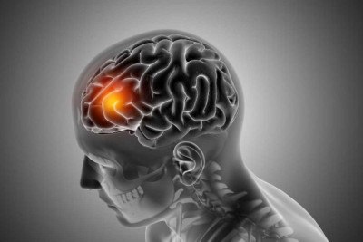 Causado pelo bloqueio de vasos sanguÃ­neos cerebrais, o AVC exige diagnÃ³stico rÃ¡pido e tratamento eficaz  -  (crédito: Freepik)