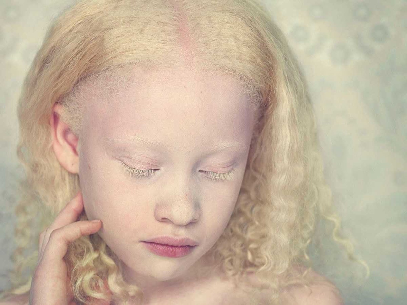 Basta de preconceito: precisamos falar sobre pessoas albinas