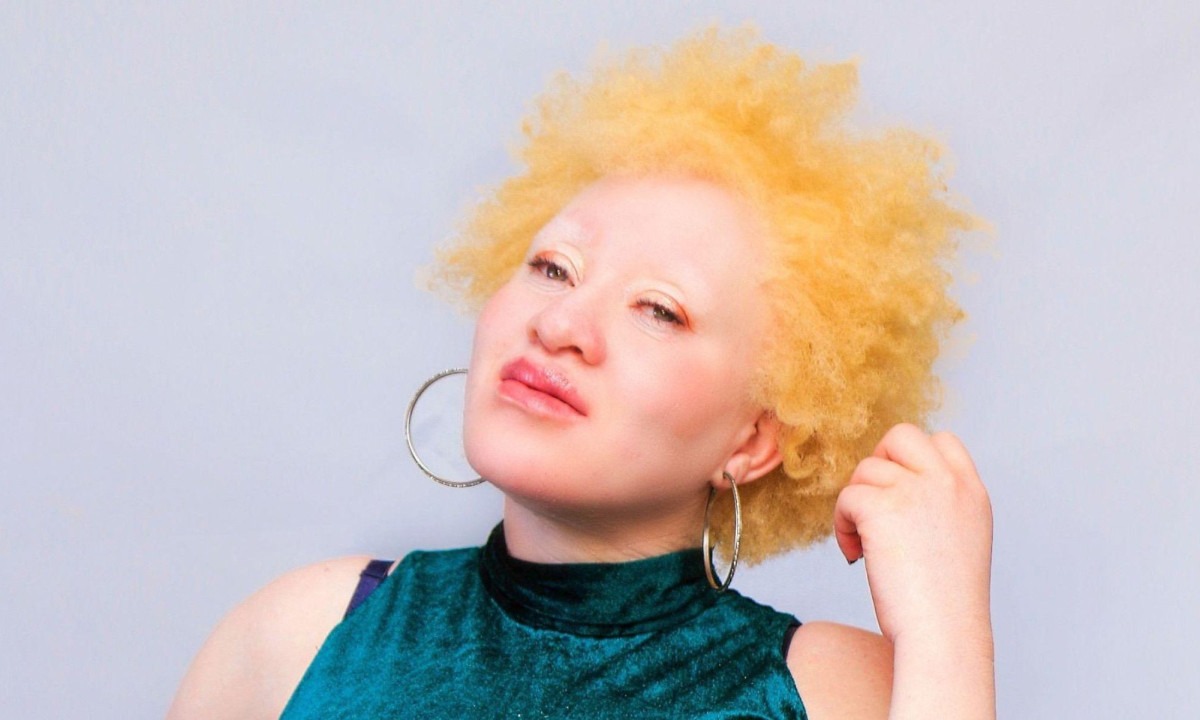 Regina diz que só conheceu os mitos que cercam o albinismo mais velha, mas que sempre sentiu ser diferente -  (crédito: Handout)