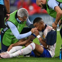 Mbappé: o que pode ser feito após uma fratura no nariz? - Ozan Kose/AFP