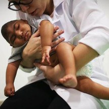 Como desnutrição, toxinas na água e agrotóxicos criaram 'bolsões de microcefalia' no Brasil - Getty Images