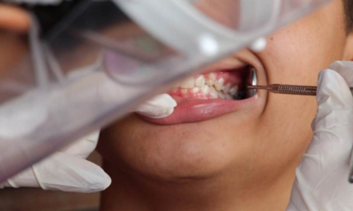 As substâncias produzidas pelo fungo são enzimas capazes de atacar os exopolissacarídeos, desintegrando o biofilme dental   -  (crédito: Laísa Queiroz/Ministério da Saúde)