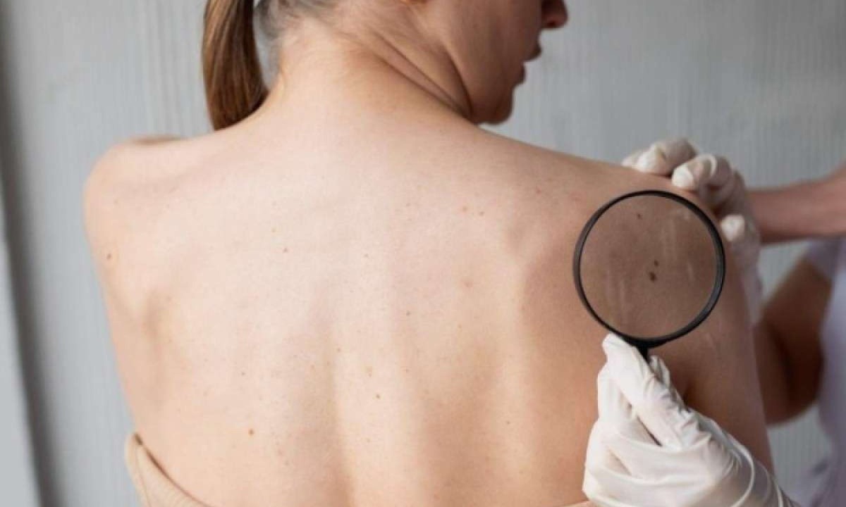 Se diagnosticado, siga rigorosamente o plano de tratamento prescrito pelo seu dermatologista  -  (crédito: Reprodução Freepik)