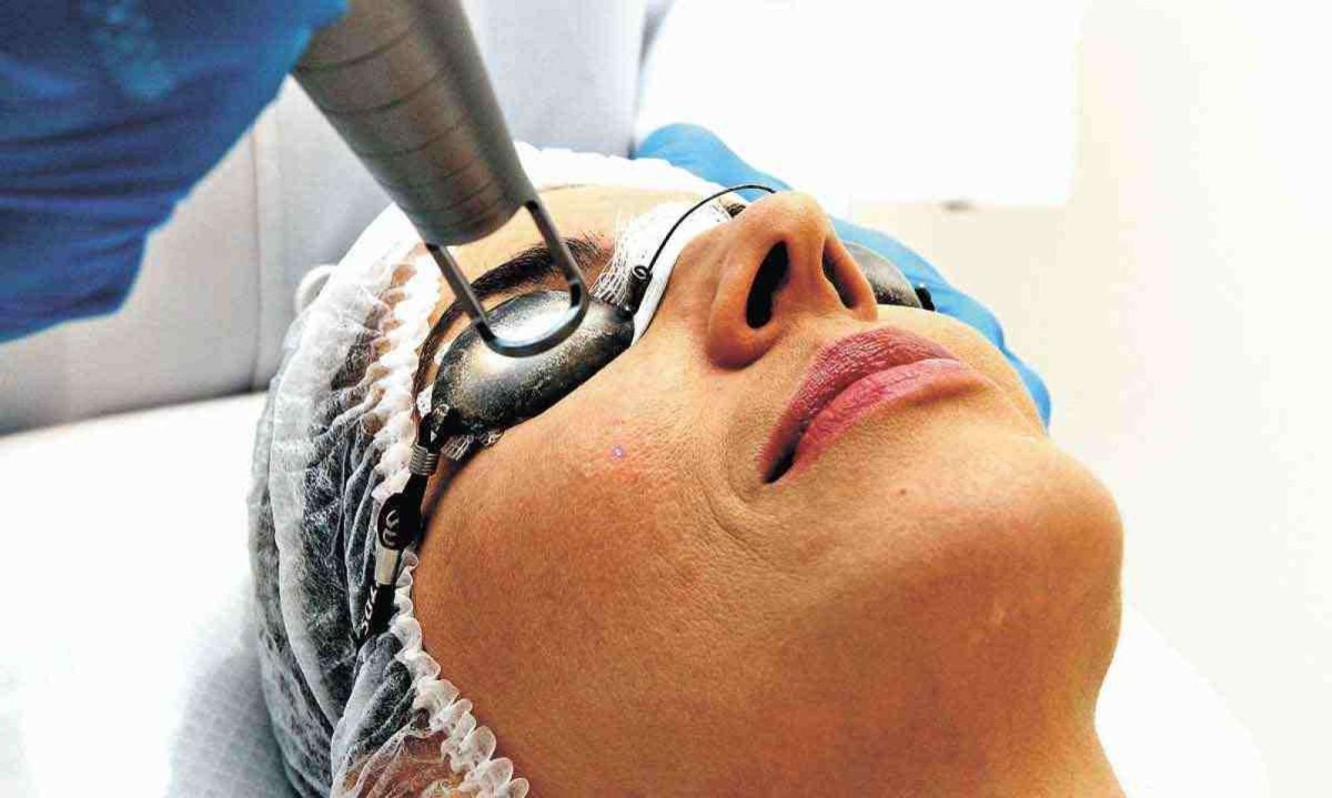 Em procedimentos a laser é utilizado creme anestésico para melhorar o conforto dos pacientes -  (crédito: Jair Amaral/EM/D.A Press)