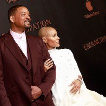 Cientistas desenvolvem novo tratamento para alopecia areata - Michael Tran/AFP/1/12/22