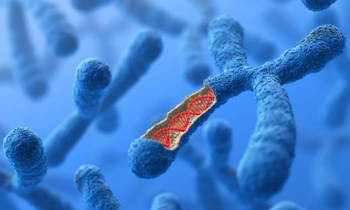 Na síndrome de Patau, há um 13º cromossomo a mais, o que gera uma série de repercussões à saúde -  (crédito: Getty Images)