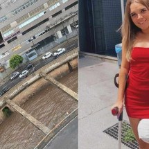 Queda no Arrudas: mulher perde perna em outro acidente com moto - Arquivo pessoal 