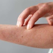  O que é transtorno de escoriação e qual seu impacto na autoestima - Freepik