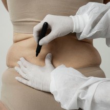 Cirurgia plástica: médico brasileiro cria técnica avançada
 - DINO