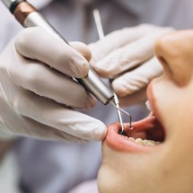 Em BH, escola para dentistas acompanha tendência de mercado - DINO