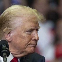 Tiro de raspão causou ferida de 2 cm em orelha de Trump, diz ex-médico da Casa Branca - BILL PUGLIANO / GETTY IMAGES NORTH AMERICA / Getty Images via AFP