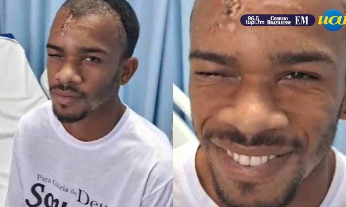 Pedreiro que teve estaca cravada na cabeça teve alta -  (crédito: Reprodução de vídeo)