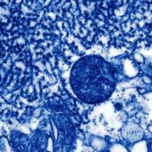 'Caçadores de vírus' rastreiam ameaças para evitar nova pandemia