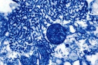 O v&iacute;rus Nipah &eacute; um agente infectuoso transmitido de animais para humanos, que pode tamb&eacute;m  ser transmitido por alimentos contaminados ou entre pessoas -  (crédito:  Reprodu&ccedil;&atilde;o de v&iacute;deo G1)