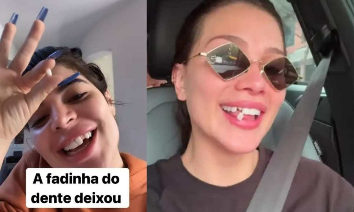 Em maio deste ano, a influenciadora Gkay ficou 'banguela' após quebrar lente de contato do dente por bruxismo -  (crédito: Reprodução/Instagram)