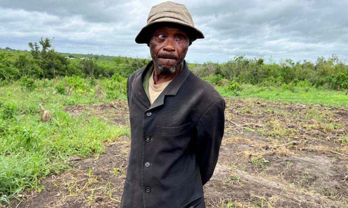 Sidi Jefwa mostra as cicatrizes deixadas no marido pelos ataques -  (crédito: BBC)