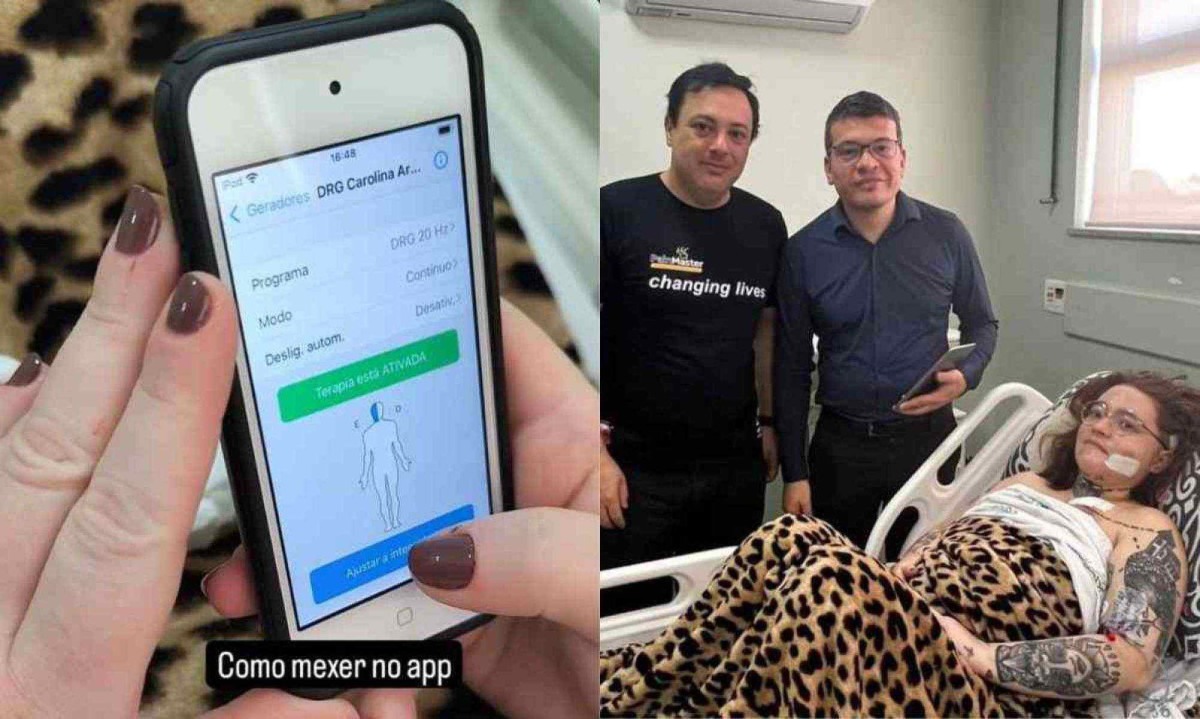 Carolina Arruda realizou cirurgia para implantar neuroestimuladores que podem ser controlados pela própria paciente em momentos de crise -  (crédito: Redes sociais/Reprodução)