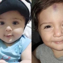 Bebê com hemofilia grave espera liberação de medicação pelo SUS - Arquivo pessoal