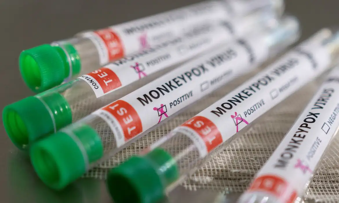 Entenda o surto de mpox na África que preocupa a OMS - EBC - Saúde
