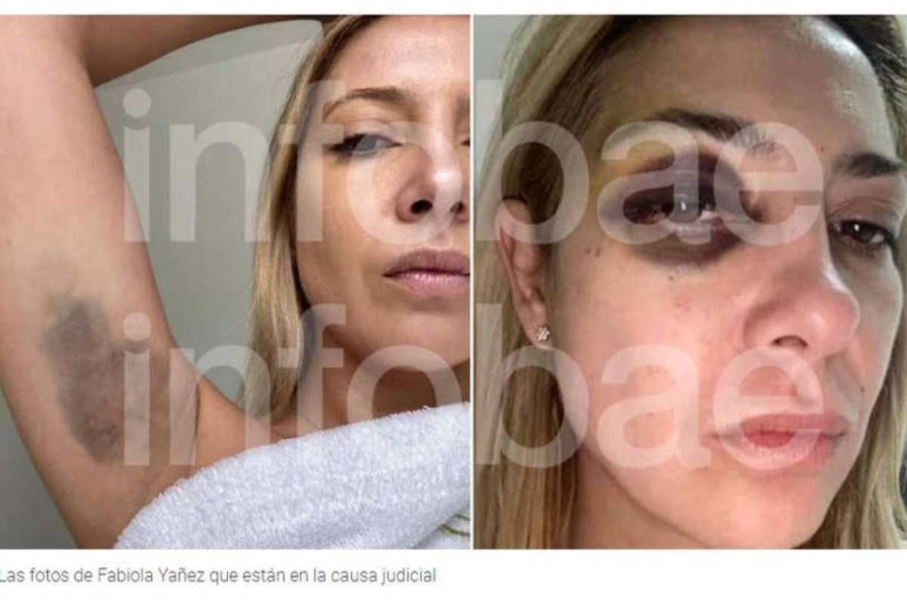 Portal Infobae revelou as fotos de Fabiola Yañez que estão no processo judicial  -  (crédito: Reprodução)