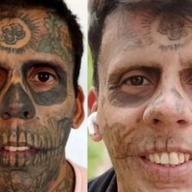 Homem mais tatuado do Brasil começa a remover tatuagens: é seguro? - Arquivo Pessoal