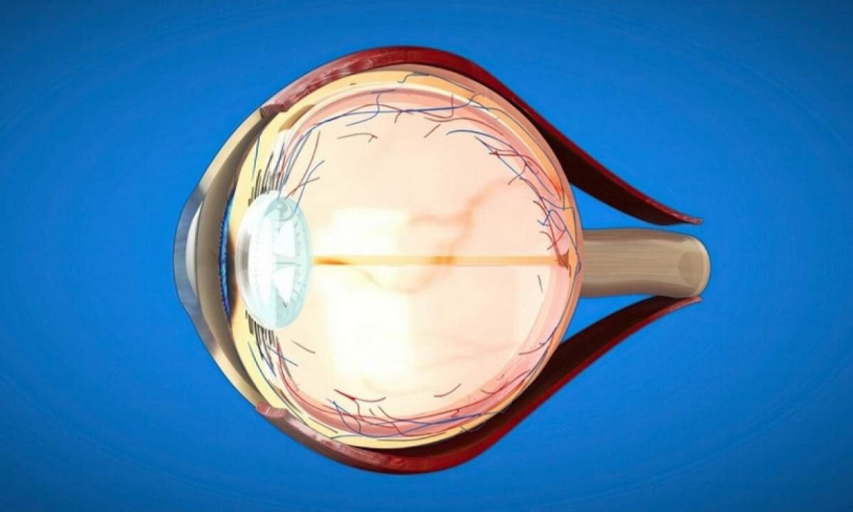 Glaucoma Ã© uma doenÃ§a inicialmente silenciosa -  (crédito: Freepik)