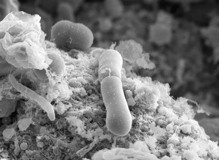 Imagem microscópica da bactéria em um intestino infectado -  (crédito: Universidade de Sheffield)