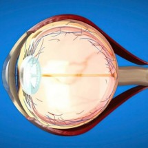 Caso Marrone: ausência de sintomas dificulta detecção precoce do glaucoma - Freepik