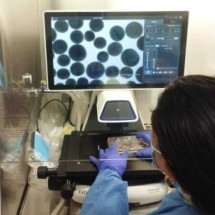 Estudo aponta relação entre a macrocefalia e gravidade do autismo - João Nanni/ Reprodução
