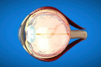 Glaucoma: SUS amplia exames, mas o desigual preocupa especialista