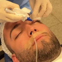 Lucas Rangel passa por cirurgia para retirar terçol; como evitar? - Redes sociais/ Reprodução
