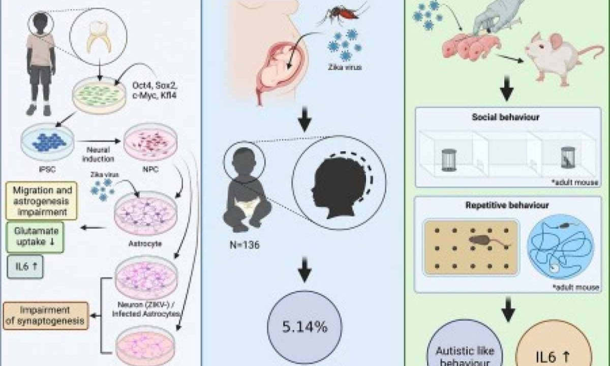 Os pesquisadores realizaram experimentos com organoides cerebrais produzidos em laboratório e infectados com o zika -  (crédito: Biochimica et Biophysica Acta – Molecular Basis of Disease)