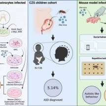 Neuroinflamação gerada pelo vírus zika aumenta risco de criança ter autismo - Biochimica et Biophysica Acta – Molecular Basis of Disease