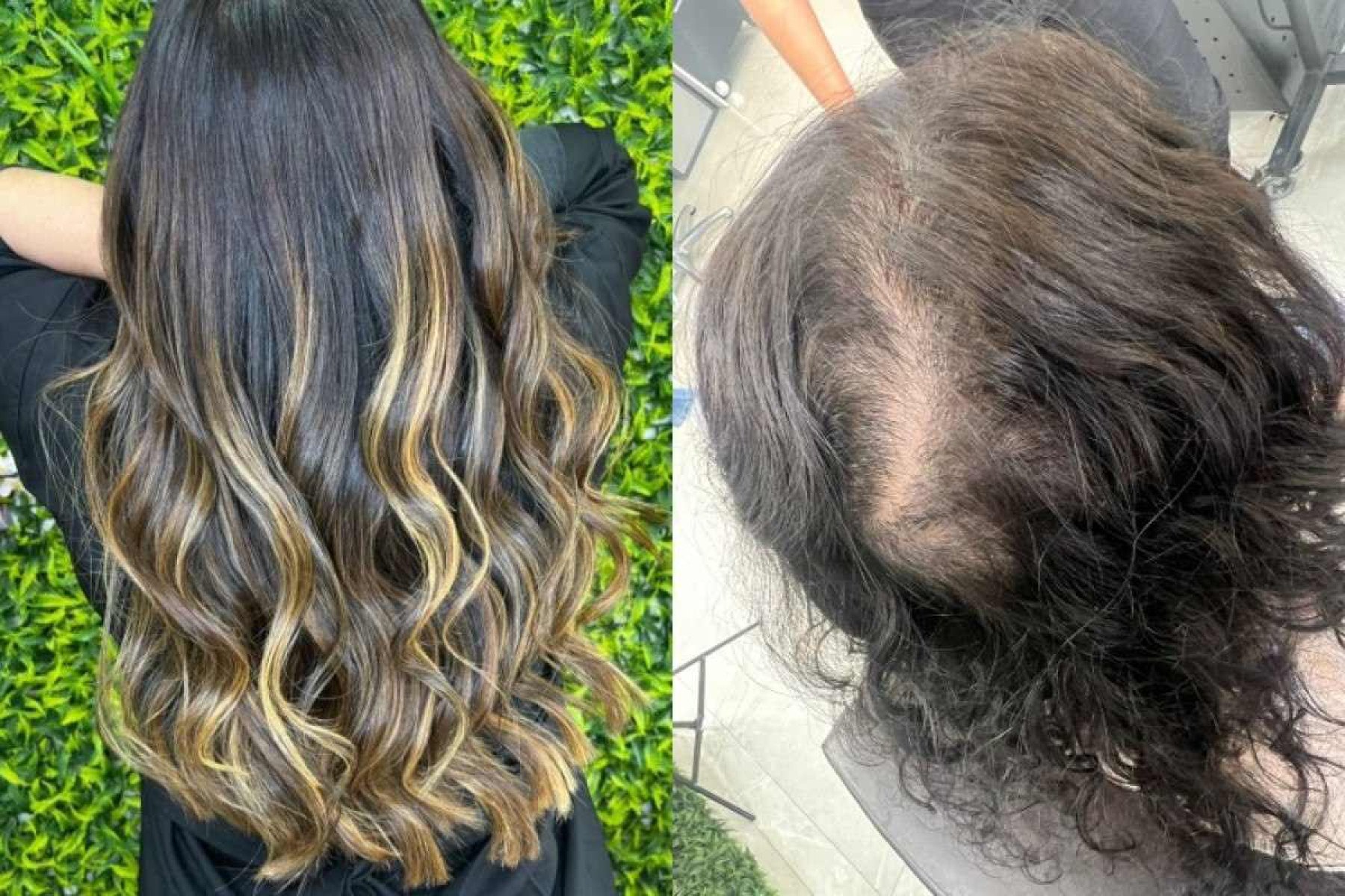 Uso de técnicas de mega hair inadequadas e ultrapassadas pode ser um problema -  (crédito: Divulgação)