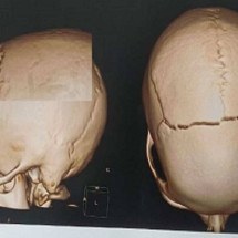 BH: homem atropela adolescente, finge socorro e foge - Raio X