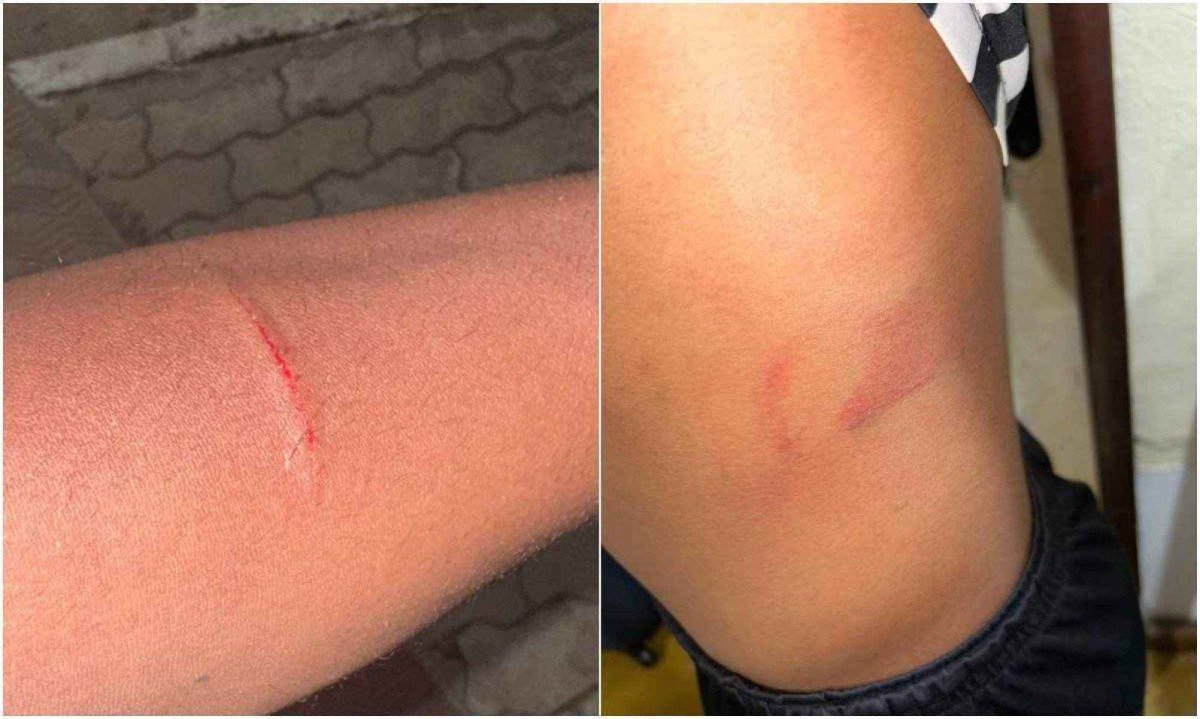 Ao Estado de Minas, a m&atilde;e de uma das v&iacute;timas, que preferiu n&atilde;o ser identificada, relatou que as agress&otilde;es ocorreram dentro do quarto dos atletas do Sub-15 do Athletic Club -  (crédito: Arquivo Pessoal)
