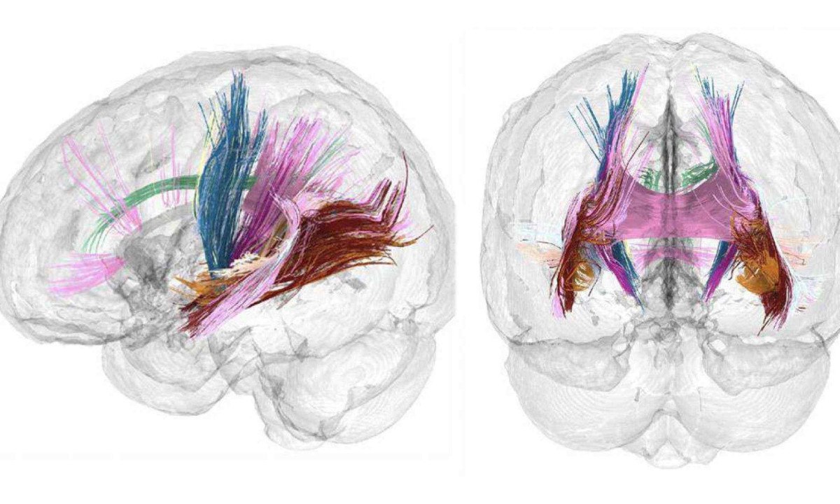 O cérebro da neurocientista Elizabeth Chrastil foi analisado repetidamente durante sua gestação -  (crédito: Elizabeth Chrastil)