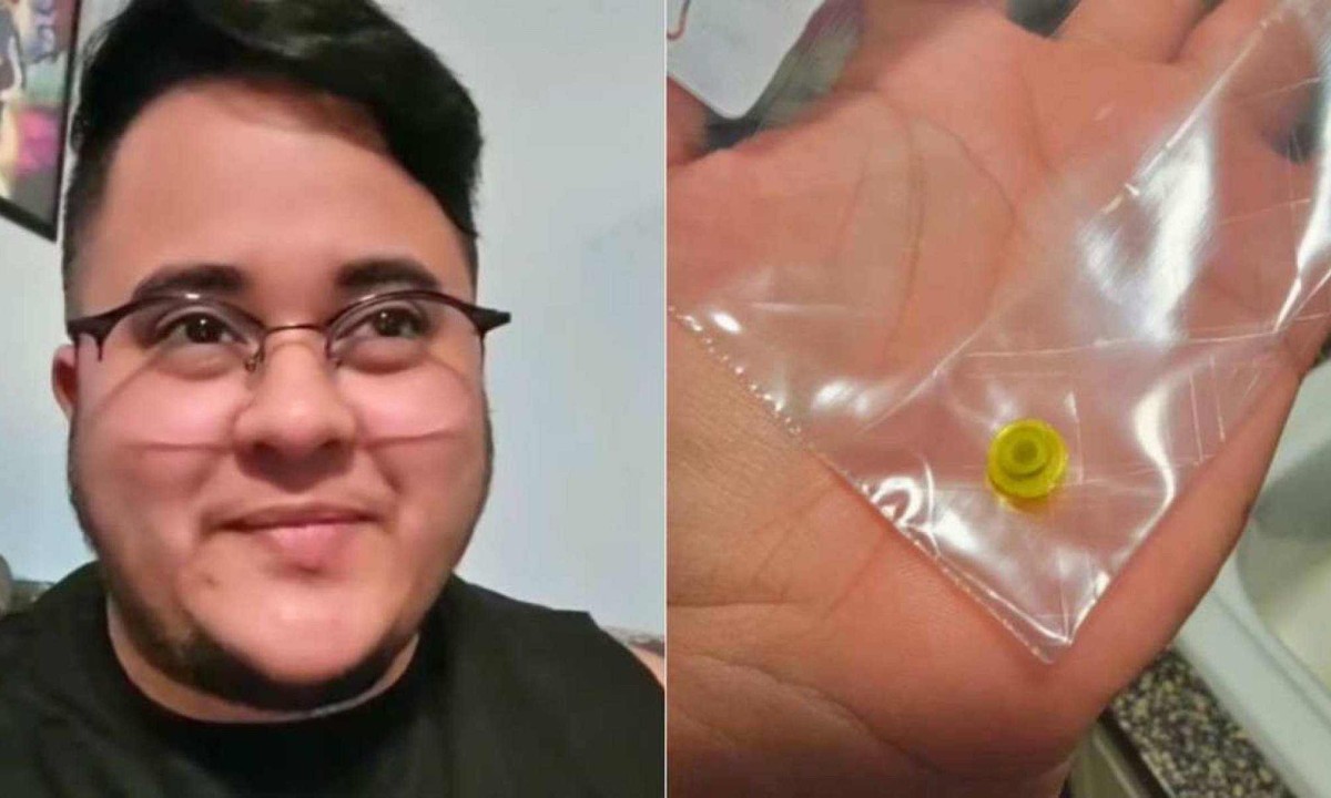 Homem conviveu 26 anos com peça de lego no nariz, sem saber -  (crédito: Reprodução / Redes sociais)