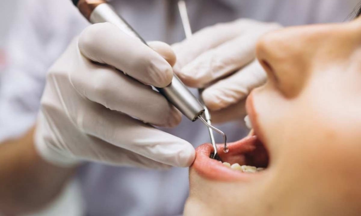 É importante manter idas regulares ao dentista, pelo menos a cada seis meses, e sempre informar durante a consulta sobre a condição de saúde geral -  (crédito: Freepik)