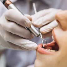 Ir regularmente ao dentista é importante também para saúde cardiovascular - Freepik