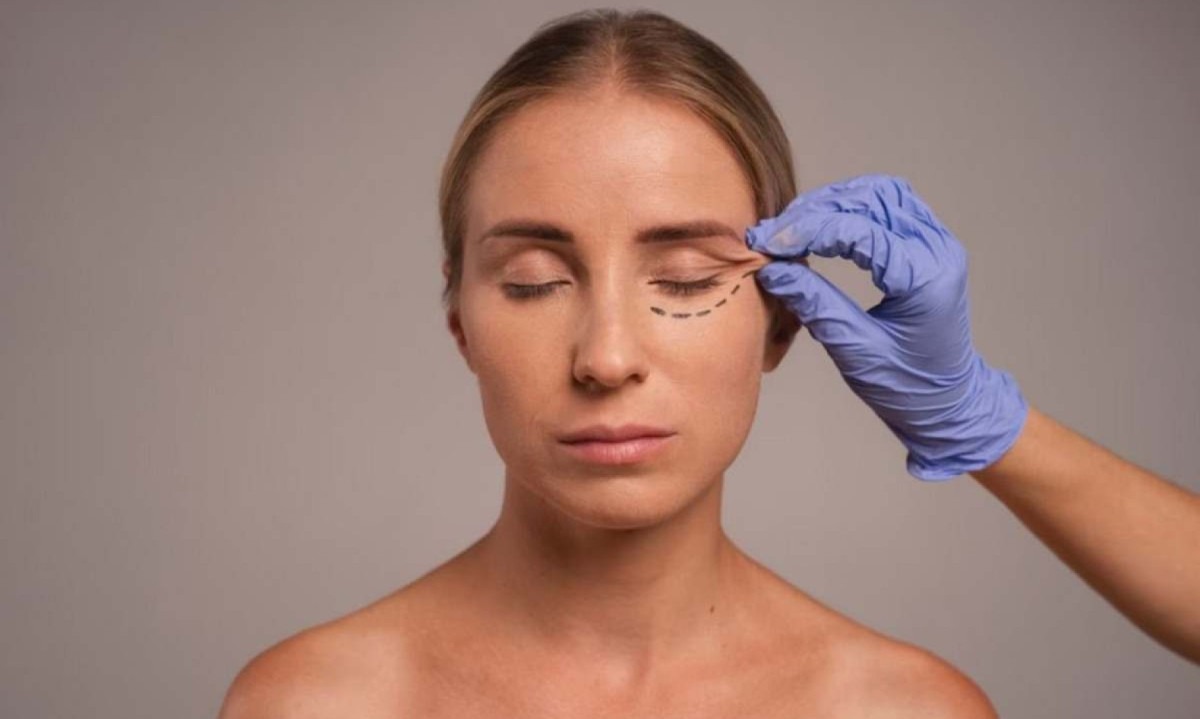 Blefaroplastia é um procedimento que impacta diretamente a autoestima e o bem-estar geral -  (crédito: Freepik)