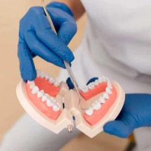 Edentulismo total – quando há perda de todos os dentes naturais, tanto na mandíbula quanto na maxila