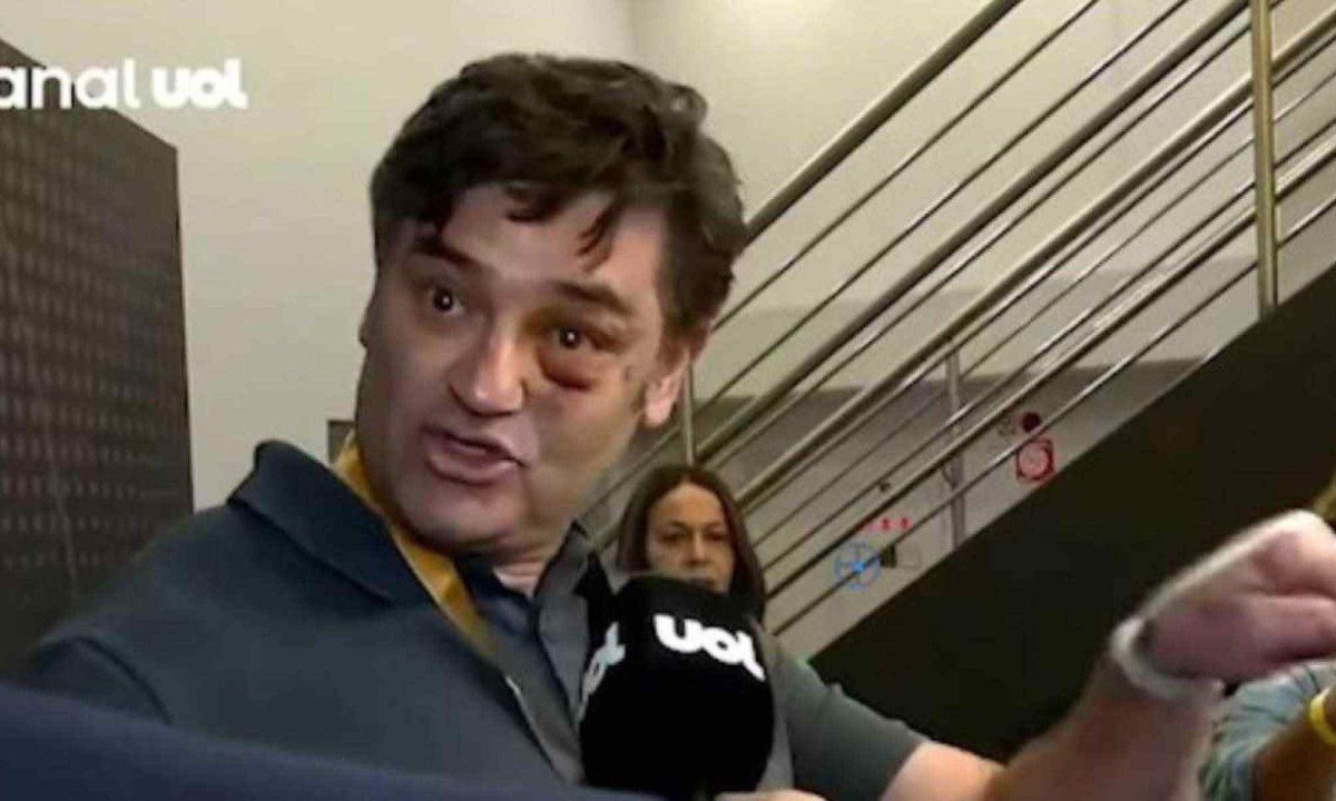 Duda Lima mostra rosto inchado após agressão -  (crédito: Folha/UOL)