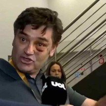 Duda Lima acusa advogado de Marçal de criar falsa prova de agressão - Folha/UOL