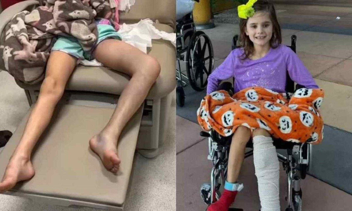 Menina de 7 anos foi picada por cascavel em um parque, mas não viu. Pais acharam que ela tinha sofrido uma torção na perna -  (crédito: Reprodução/GoFundMe)