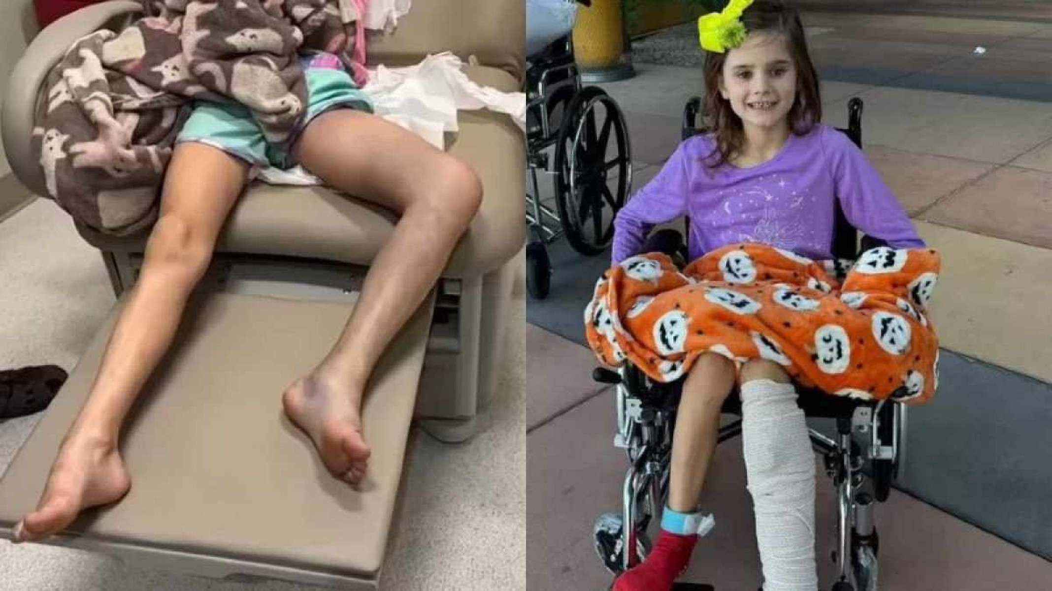 Menina de 7 anos foi picada por cascavel em um parque, mas não viu. Pais acharam que ela tinha sofrido uma torção na perna -  (crédito: Reprodução/GoFundMe)