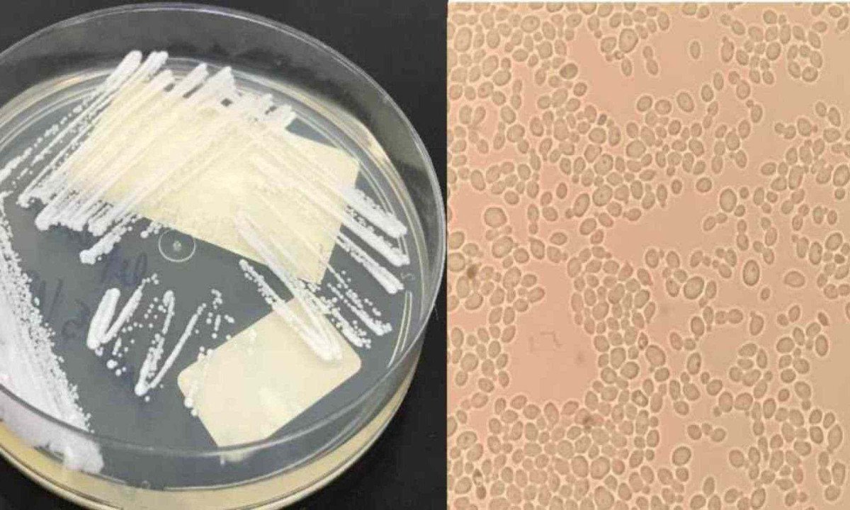 Outras 24 pessoas aguardam resultados da testagem do supefungo -  (crédito: Reprodução nota técnica GVIMS/GGTES/ANVISA / Laboratório de Micologia, Hospital das Clínicas da Faculdade de Medicina da USP, 2020)