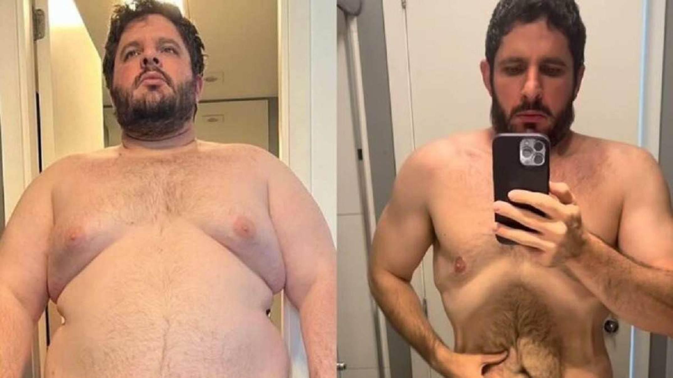 Lipo? Bariátrica? Não! Ex-Masterchef conta como perdeu 83 kg