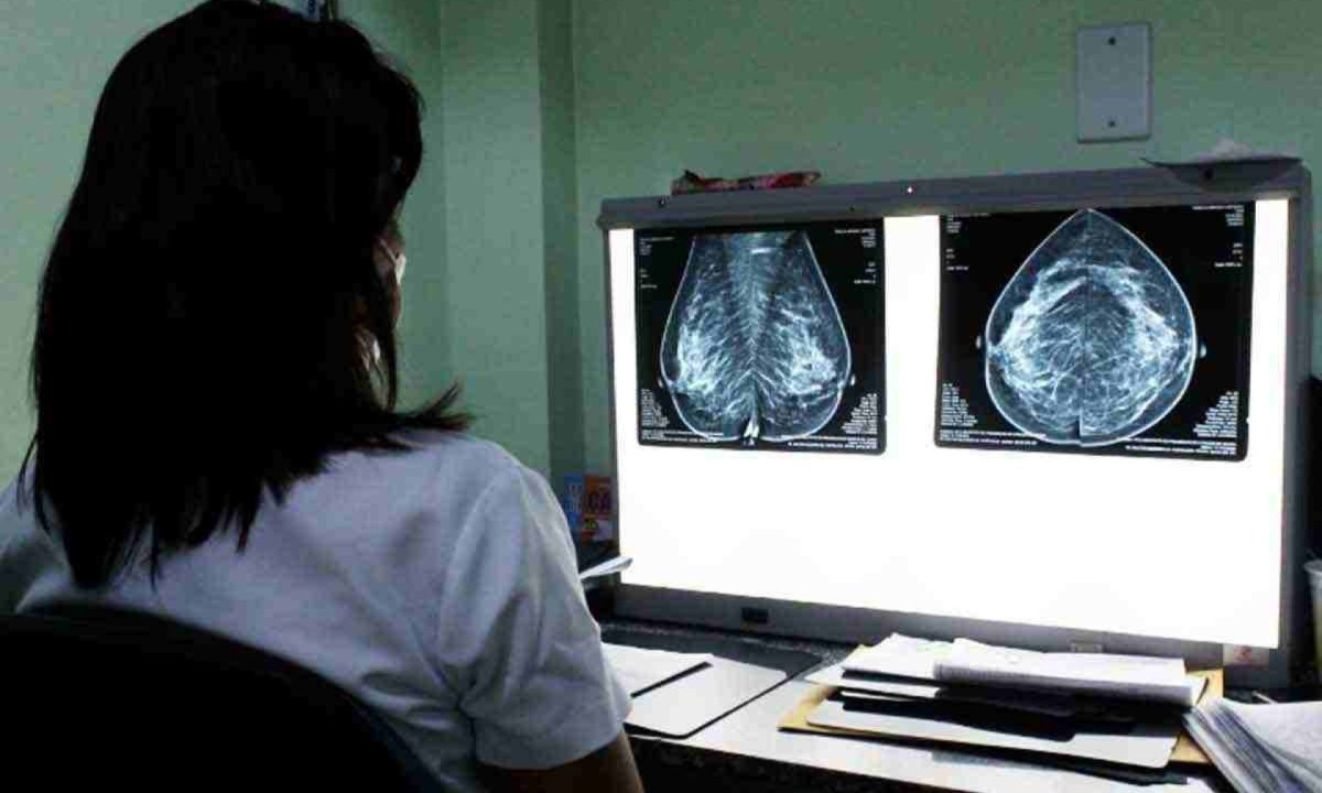 Mamografia é importante para detectar cedo o tumor em jovens mulheres
 -  (crédito: Reprodução)