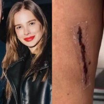 Vera Viel detalha como será tratamento após retirada de tumor - Reprodução/Instagram